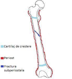 cartilaj