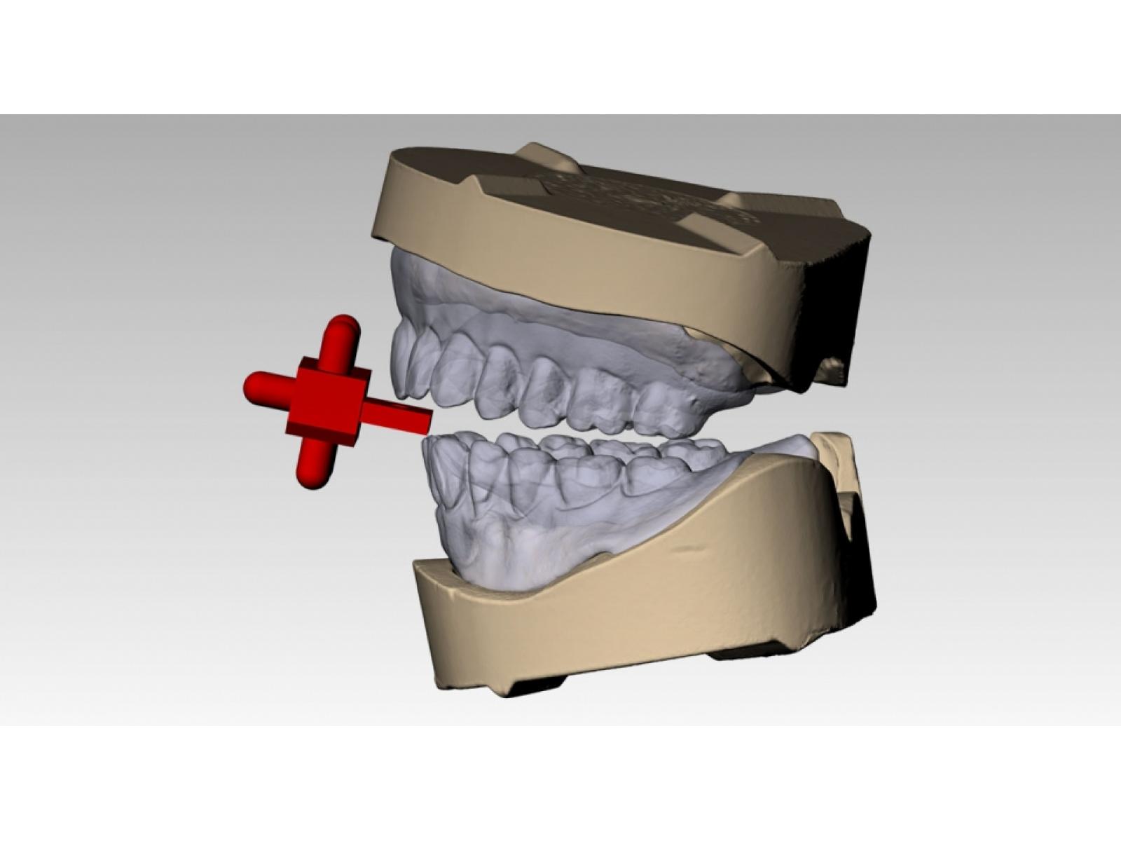 Dr.Cristian Gheorghiu - medic dentist implantolog - 3planificare_3d.jpeg