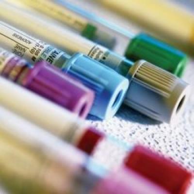Pregatire pentru recoltare