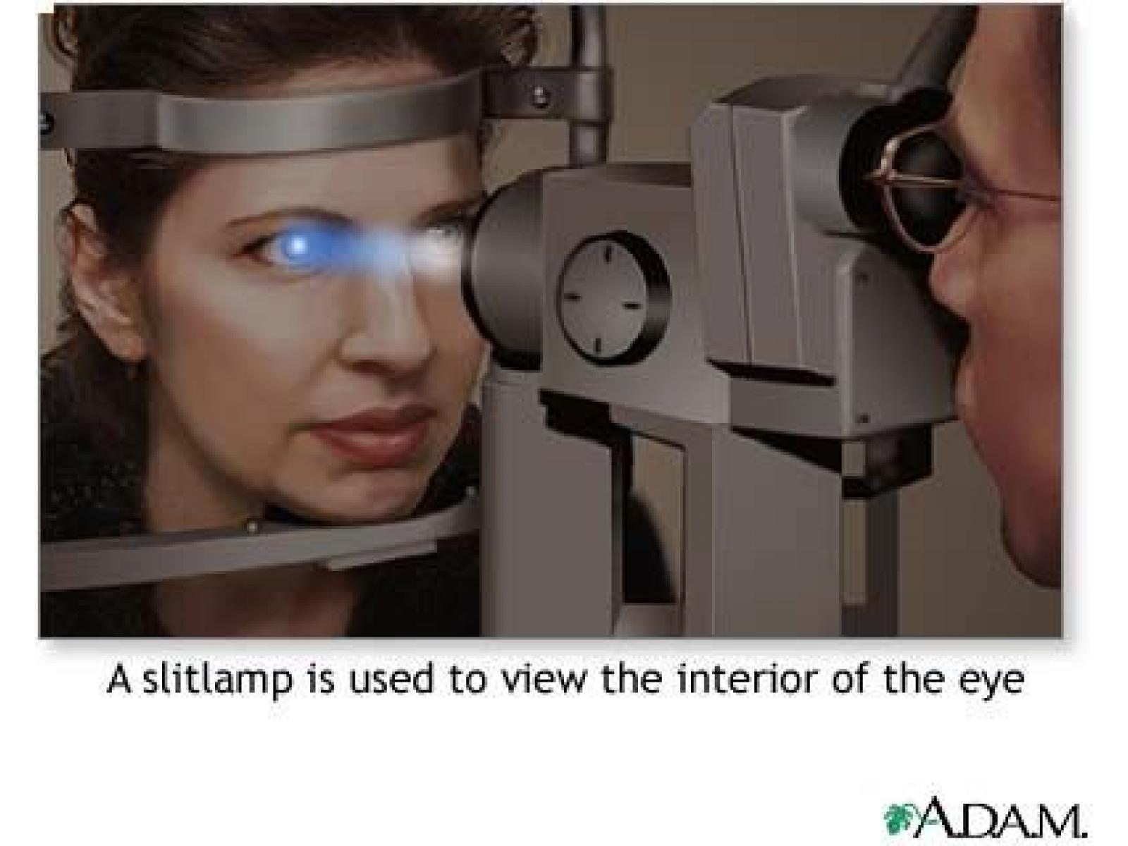 Cabinet oftalmologic & optica medicala CONSTANTA - laser.JPG
