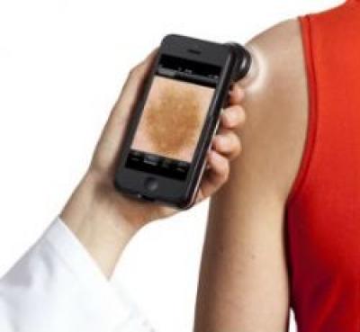 Dermatoscopia digitala