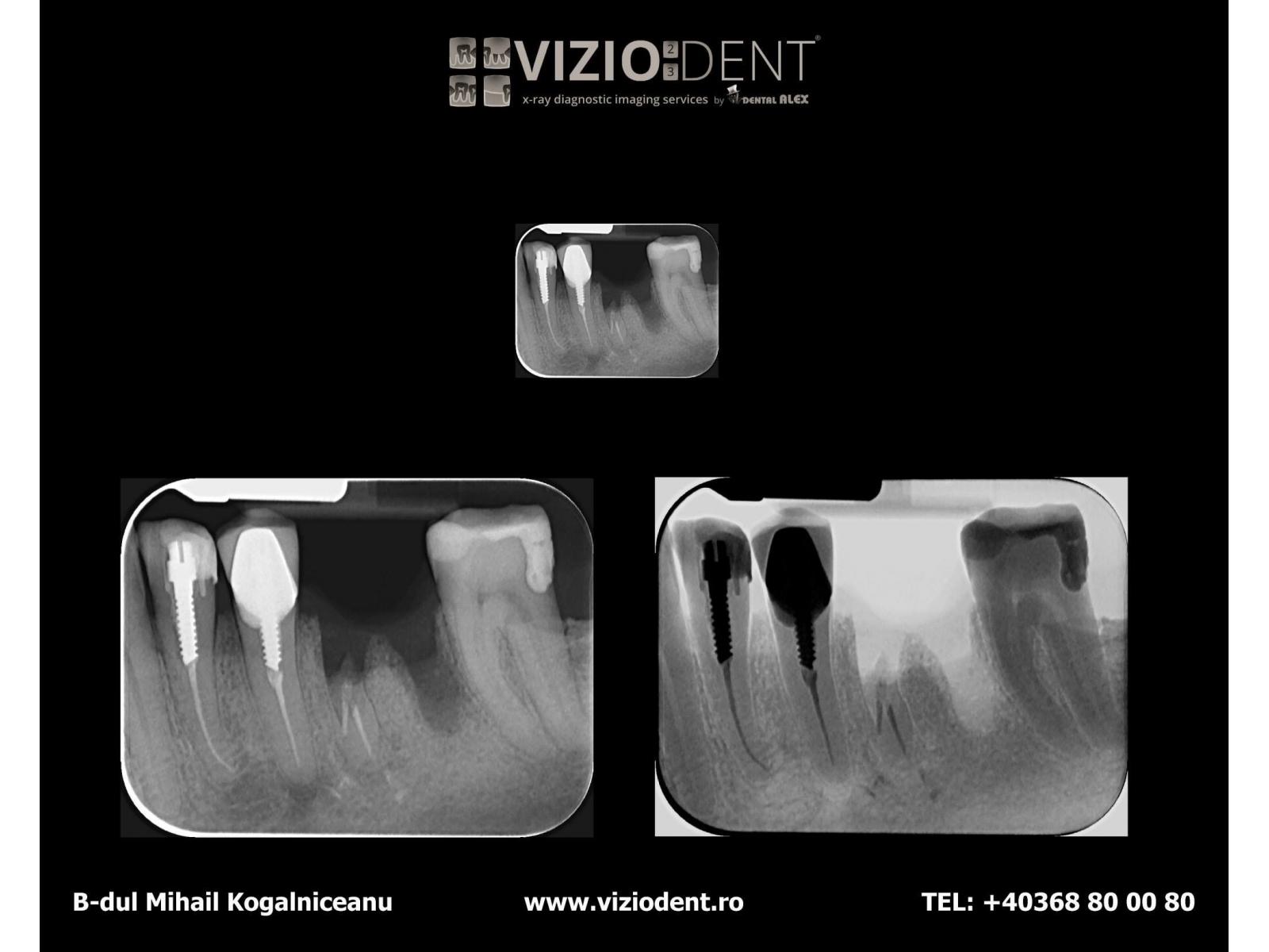 VIZIODENT - Centru radiologic si tomografie dentara - image.jpg