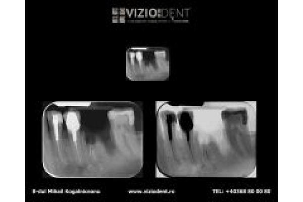 VIZIODENT - Centru radiologic si tomografie dentara - image.jpg