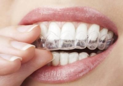 INVISALIGN
