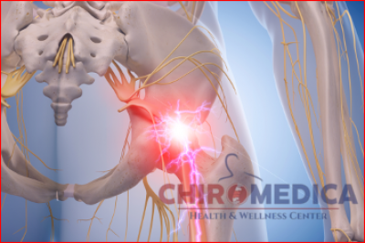 Tratament lombosciatica