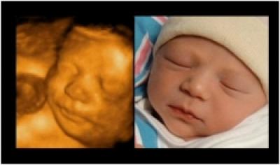 Calendar de sarcina: cand se fac ecografiile morfologice si de ce. O viziune detaliata. 