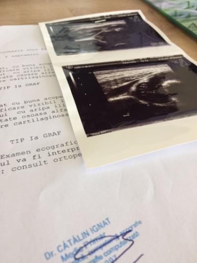 Ecografia de sold, prima investigatie imagistica din viata nou-nascutului