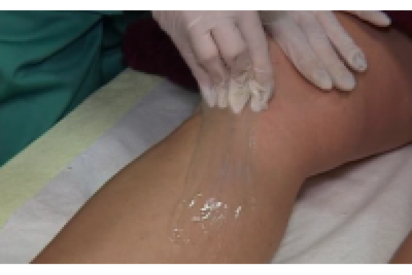 Dermavital -  Biorezonanta  Centru German - ipl_pasta.png