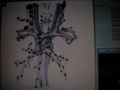 Limfa si bolile neurodegenerative