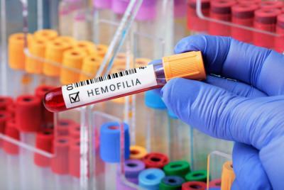 Hemofilia – boală cronică gravă