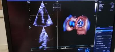 Examenul cardiologic pentru persoanele cu varsta intre 40-65 ani