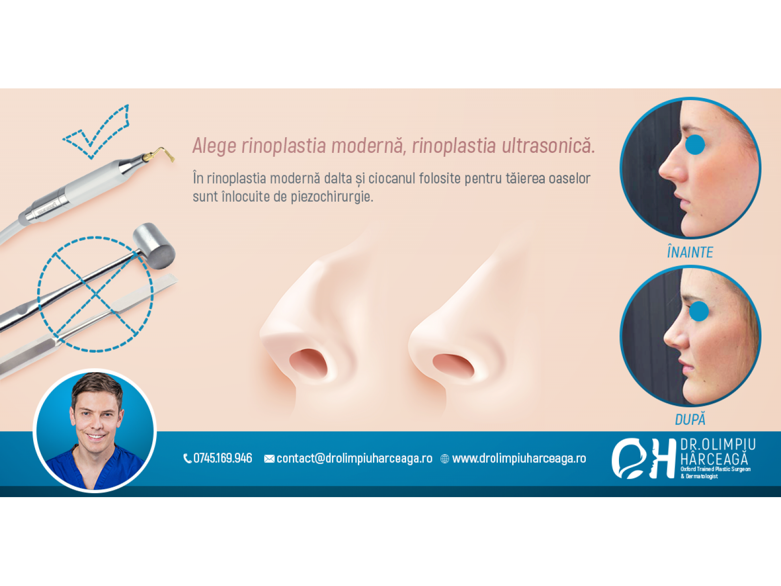 Dr Olimpiu Harceaga - Afis-Servicii---Dr-Olimpiu-Harceaga---Rinoplastie---Ads---1200x628-pxl.png