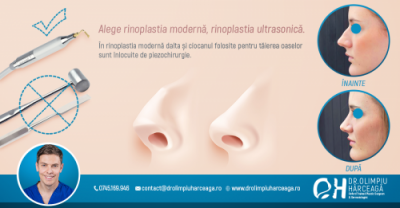 Rinoplastia ultrasonica