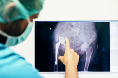 Artroplastia la Elytis Hospital Iași: indicații și avantaje