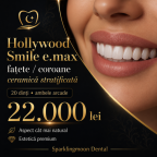 Fatete dentare