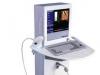 Fibroscan