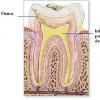 Abcesul dentar