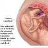 Sindromul alcoolismului fetal