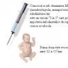 Trivaccinul antirujeolic, antirubeolic, antioreionic (vaccinare neinclusa in programul national de imunizari)