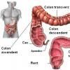 Profilaxia cancerului colorectal