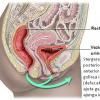 Infectia tractului urinar la tineri si adulti