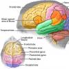 Reabilitarea post accident vascular cerebral