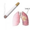 Fumatul produce cancer pulmonar