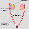 Cauze anatomice de infertilitate - Uter