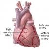 Bolile cardiovasculare