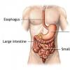 Hemoragia gastro-intestinala