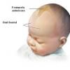 Forma capului la bebelusi: ce este normal?