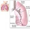 Pneumoniile bacteriene si pneumoniile atipice