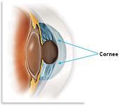 Abraziunile corneene