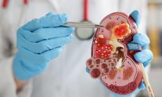 Agenezia renala: absenta rinichilor si consecintele sale