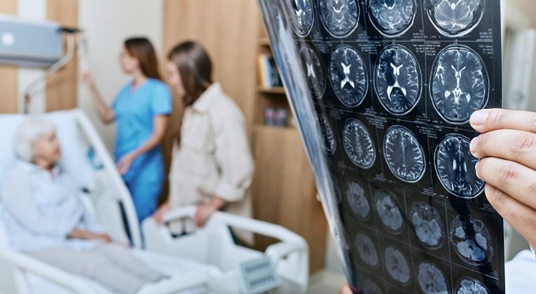 Boala Alzheimer, cea mai raspandita boala neurodegenerativa