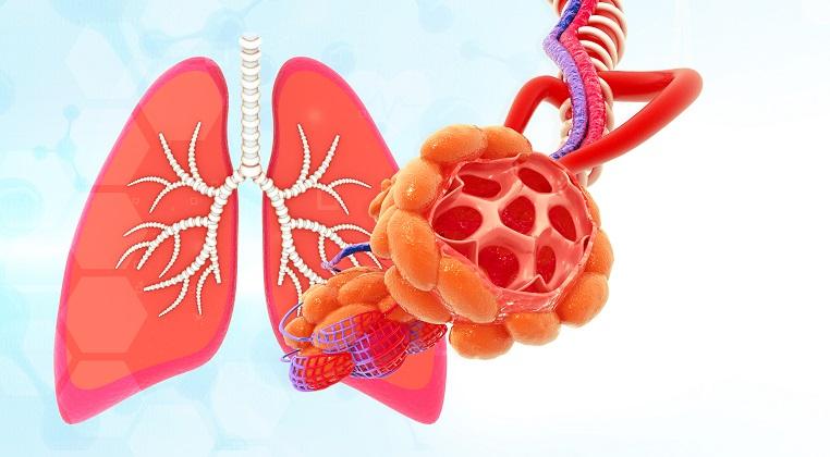 Explorarea bolilor rare pulmonare: prezentare, diagnostic si tratament