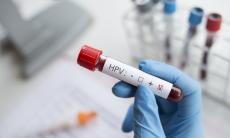 Cum se manifesta infectia cu HPV la barbati