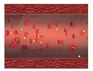 Ischemia arteriala periferica