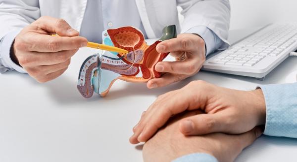 Cum tratam corect prostatita acuta