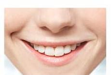 Reconstructia zambetului: fatetele dentare din portelan