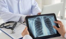Screeningul pulmonar - instrument de diagnostic precoce al cancerului 