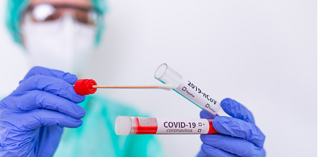 Cand se recomanda testele PCR si testele pentru anticorpi COVID-19.  Specialistii MedLife explica