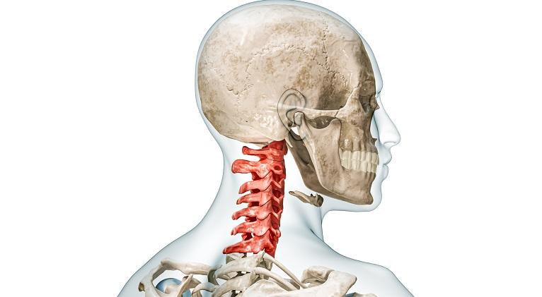 Siringomielia, o afectiune neurologica asociata cu malformatii congenitale ale creierului