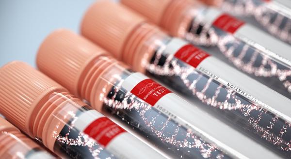 Testul de paternitate prenatal