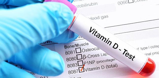 VITAMINA D3 - indispensabila in raceli, gripe si afectiuni ale tractului respirator