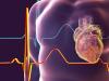 Tipuri de ablatie cardiaca si tratamentul acestora