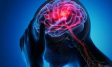 Preventia accidentului vascular cerebral
