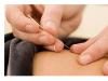 Acupunctura si beneficiile sale