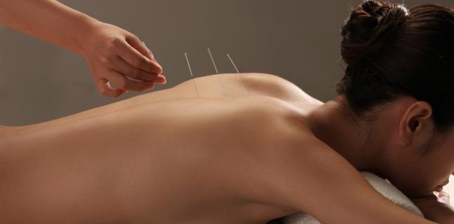 Cum functioneaza si ce este acupunctura?