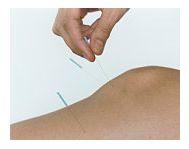 Acupunctura si infectiile urinare